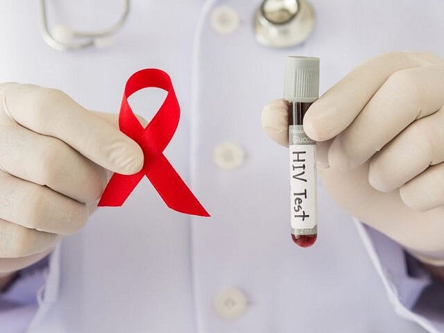 Тестирование на ВИЧ